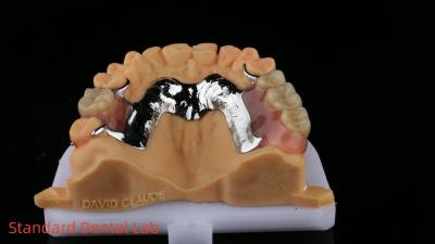 China CorCr Metal Parcial Dentura Alta Luz Berílio Livre Ivoclar Scheftner Confortável Metal Framewrok à venda