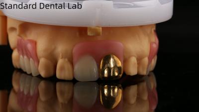 China Dentes de acrílico completo com dentes de ouro amarelo/dentária temporária dentadura de acrílico Ivoclar profissional aprovada pela FDA à venda