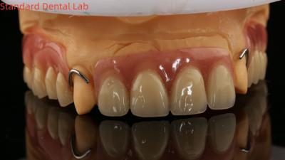 Cina Dentiera parziale di acrilico con cura termica Laboratorio dentale di alta precisione con modello di stampa 3D in vendita