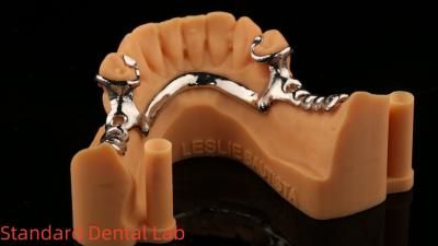 China Las aleaciones metálicas parcialmente el cobalto y el cromo las dentaduras Ivoclar Scheftner Confortable China laboratorio dental en venta