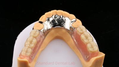 China Ligações metálicas Cobalto Cromo Dentadura parcial Ivoclar Scheftner Confortável Quadro de Metal Fundido à venda