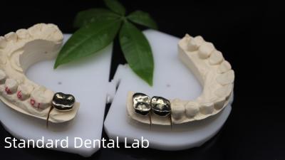 China Profissional ISO e FDA aprovado coroa de ouro amarelo para laboratório dentário Envio UPS ou Fedex Tempo de produção 2 dias à venda