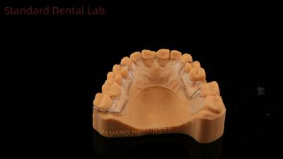 China Perfekt geeignet Deutschland Ortho Zähne Halley Retainer für Ästhetik und Anpassung Klar Schatten SDL Dental Lab zu verkaufen