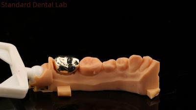 China High Nobel Yellow Gold Crown Tooth Professional Ni Be Free ISO And FDA Approved China Dental Lab for sale