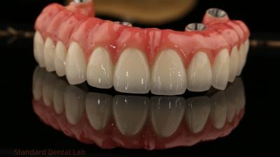 Cina Impianti di zirconia a arco pieno ponte di zirconia corona vita ombra personalizzata tutti su quattro / sei impianti dentali in vendita