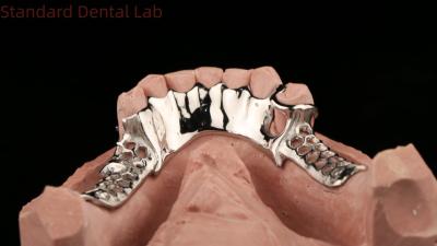 China Cobalt Cromo Quadro de Metal Fundido Dentes Parciais Com Avental Inferior Design SDL Dental Lab à venda