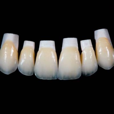 China Coroa de veneers de porcelana Emax de alta translucidez com melhores materiais por Ivoclar Vivadent à venda