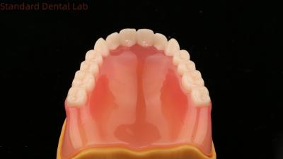 China Complete Denture Ivoclar Full Denture Acrylic Teeth SDL Dental Lab for sale