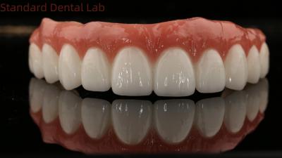 China Coronilla de zircónia dental de alta calidad y implantes All On Four Six Full Arch / China Laboratorio dental Manufacturer en venta