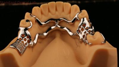 China Quadro de metal fundido superior Dentes parciais fortes Leve e durável à venda