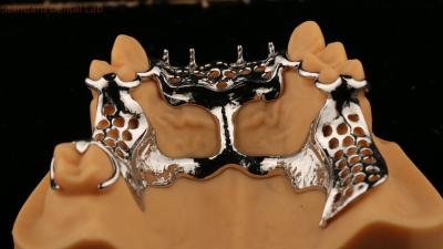 China Quadro superior fundido Dentes parciais de metal acrílico Forte leve e durável à venda