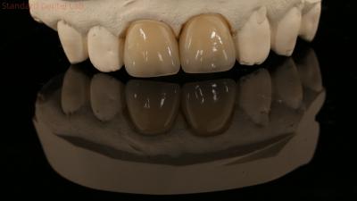 China Volledige contour Zirconia kroon en hoge esthetiek natuurlijke gebit brug 5 jaar garantie Te koop