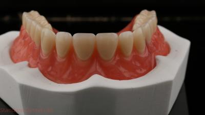 China Dentsply Lucitone 199 Acrylic Denture For Full Arch Natural Look for sale