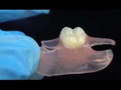 Dental TCS Valplast Flexible Partial Dentures Nesbit Valplast Finish China Dental Lab Valplast Clasp