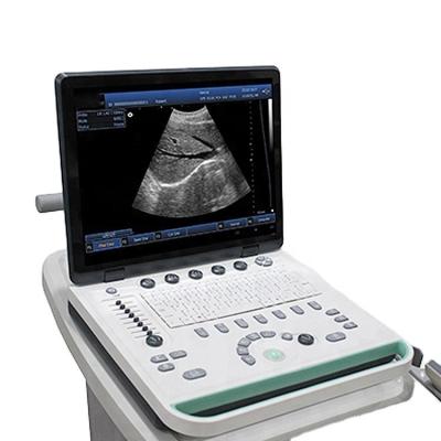 China Plastic 15 In LED Screen 3D Use B/W Notebook Human Ultrasound Scanner Machine With libattery for sale