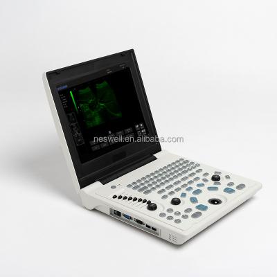 China Metal 12 in LED Screen Notebook B Ultrasound Scanner Machine Gynecological / Pregnancy Ultrasound Machine with libattery for sale