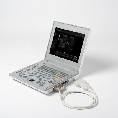 China Plastic 12 In LED Screen Use Notebook B Human Ultrasound Scanner Machine With Libattery for sale