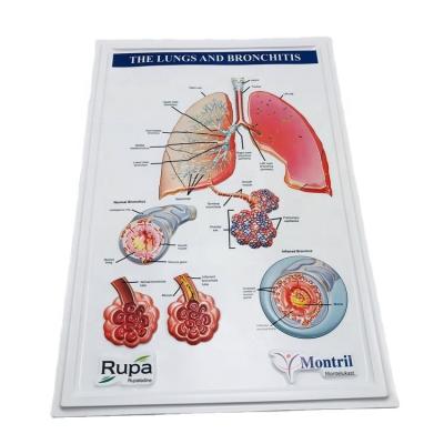 China 3D embossed /blister 2020 new product 3D PVC embossed medical poster with lungs and bronchitis diagram for sale