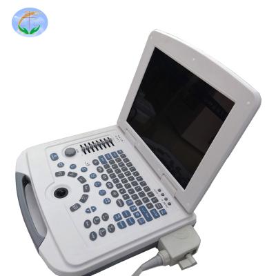 China Hot Selling Cheap Portable GYN Full Digital Trolley Ultrasound Scanner Equipment Black And White With Convex Probe for sale