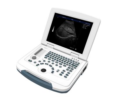 China Cheap Portable Hospital Digital Full Back And White Ultrasound Machine For Abdomen With Convex Probe for sale