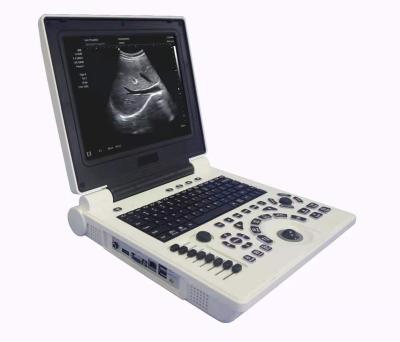 China YJ-E20 Hospital Laptop Color Doppler Ultrasonic Diagnostic System for sale