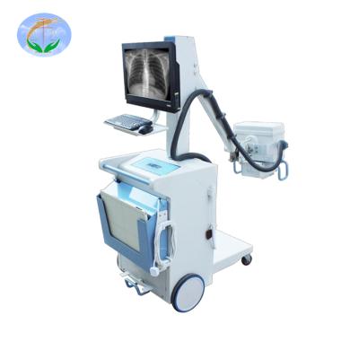 China 5KW 100mA Factory Price Hot Sale Physical Examination Machine Plastic CE Approved Good Quality Digital Mobility X-ray Machine for sale