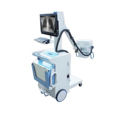 China CE Approved Plastic Hospital Room 100 mA Medical X Ray Mobile Digital Cheap Medical Equipment for sale