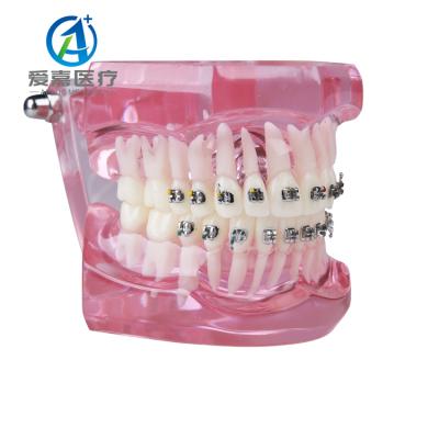 China Original Factory Vivid Anatomy Frames Metal Orthodontic Teeth Dental Anatomical Models Model With Best Price for sale