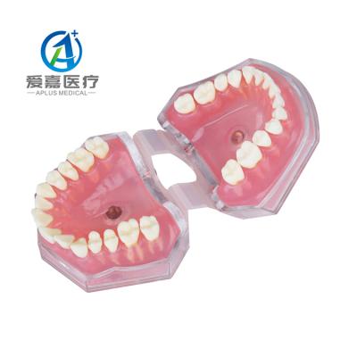 China Wholesale Vivid High Quality Soft Extractable Gum Model For Dental With Anatomy Removable Teeth for sale