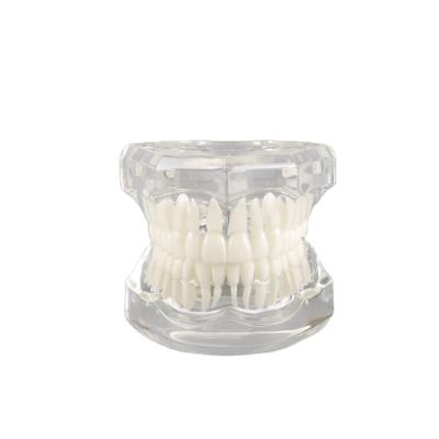 China Vivid Anatomy Demo Dental Teeth Model Typodont Orthodontic Transparent No Braces For Adult Education for sale