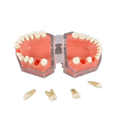 China Vivid Anatomy Hot Selling Soft Sticks Typodont Extraction Teaching Tooth Anatomy Model Medical Science With Cheapest Price for sale