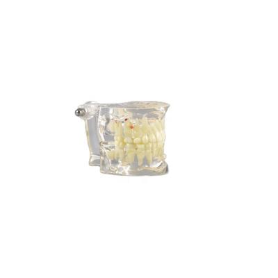 China Factory Clear Original Child Structure Display Pathological Dental Teeth Model Transparent For Age 6-9 for sale