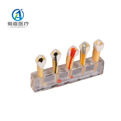 China Detailed Human Structures Good Price Model Endodontic Educational Supplies Dental Model For Patient Teaching for sale