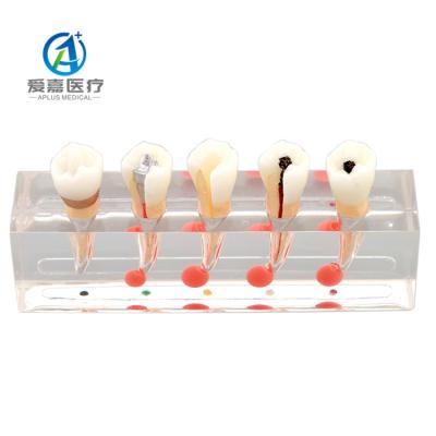 China Affected Human Structures Interesting New Design Dental Root Canal Models For Patient Teaching Endodontic Model for sale