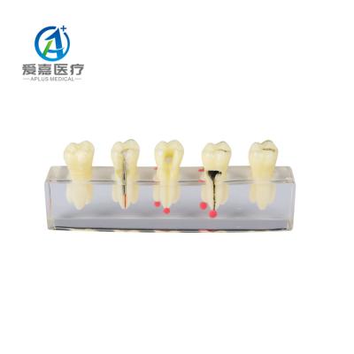 China Good Quality Dental Model Endodontic Modelos De Estudio Para Endodoncia Detailed Human Structures Root Canal For Education for sale