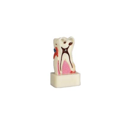 China Detailed Human Structures Grade Eco-friendly Teeth Supplier Tooth Pathology Dental Model Cheap With Fast Shipment for sale