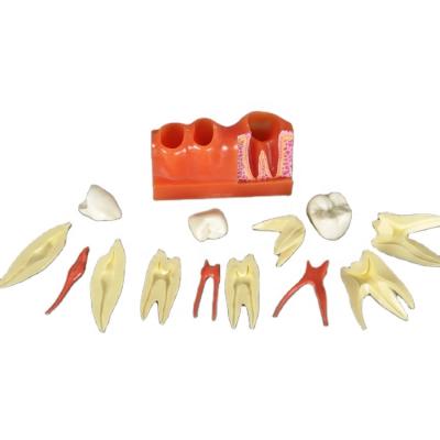 China Detailed Anatomy Structures 4 Fold Tooth Model For Explaining Endodontics Teacher Supplies Educational Anatomy Model for sale