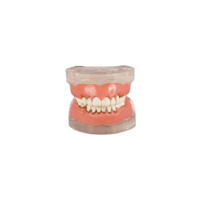 China Manufacturer Clear Structure Display Model Dental Supplies Perio Model Dental Study Model With Clear Root For Education for sale