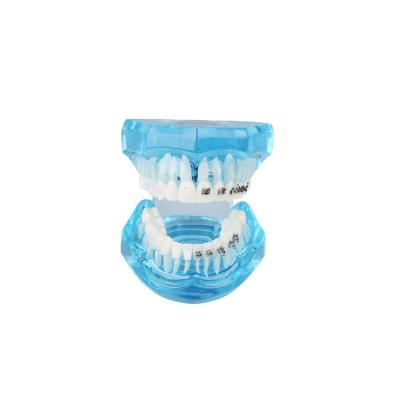 China New Transparent Vivid Anatomy Semimetal Model Dental Models For Orthodontic Patient Teaching for sale