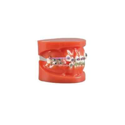 China Detailed Anatomy Structures Popular Style Cheap Price Metal Dental Teaching Brackets Orthodontic Model Brackets For Demonstration for sale