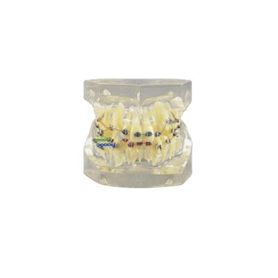 China Wholesale Price Clear Buccal Tube Structure Display Orthodontic Dental Model With Transparent Gingiva for sale