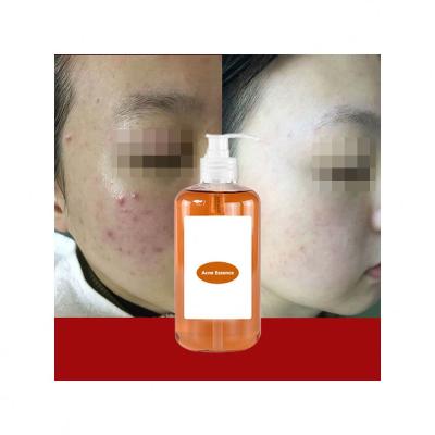 China Moisturizer Plant Extract Skin Firming And Tightening Anti Cellulite Body Massage Oil For Women Bulk Ingredients for sale