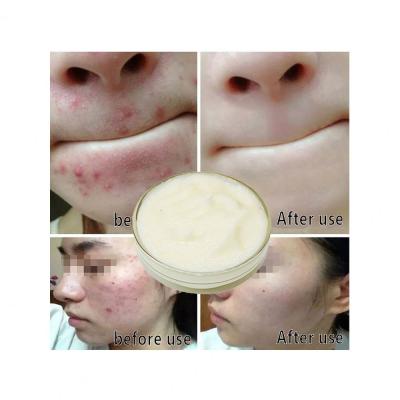 China OEM Bulk Factory Wholesale Moisturizer Ingredient Magic Hydration Night Cream Whitening Skin Cream for sale