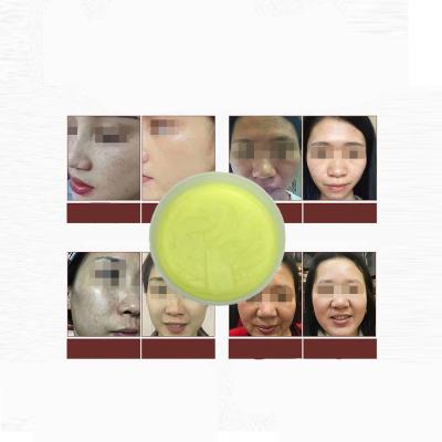 China Bulk Moisturizer Ingredient OEM Bulk Cosmetic Face Cream Whitening Whitening Face Cream for sale