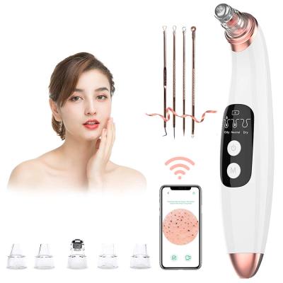 China Acne Treatment Blackhead Suction Tool Plump Deep Clean Vacuum Camera USB Electric Rechargeable Acne Comedone Extractor Kit for sale