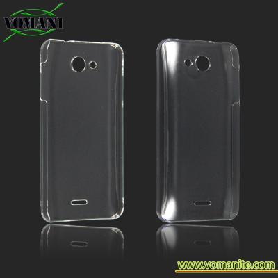 China Hard PC COVER case for Kyocera DIGNO U, Japanese phone case,SKIN for sale