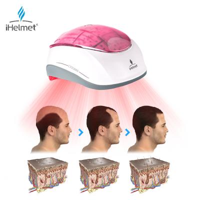 China True Household iHelmet Red Light Therapy Laser 650nm Infrared Hair Growth Helmet For Hair Regrowth for sale