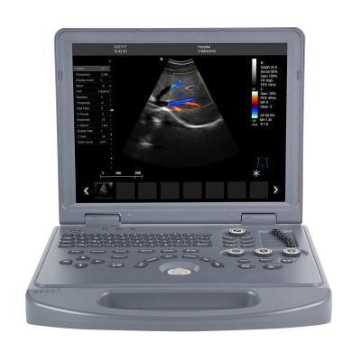 China Hot Sale Metal Ultrasound Scanner Portable Handheld Pregnancy Scanner Ultrasound For Women 3D for sale