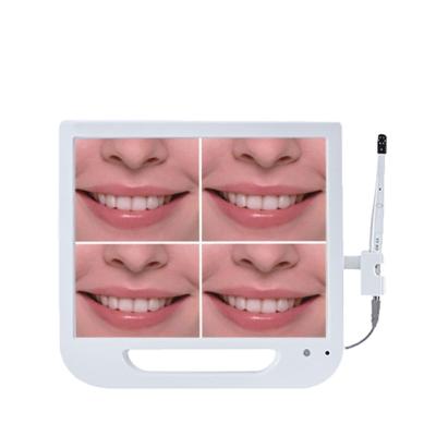 China Dentistry Low Price CE Approved Dental Intraoral Camera for sale