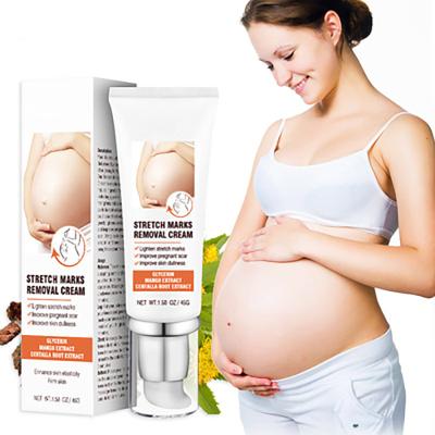 China Hot Sale Vegan Natural Organic Herbal Scar Repair Best Natural Organic Herbal Scar Brightening Anti Stretch Mark Removal Cream For Stretch Marks for sale